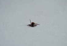 Czemu zbiera się limfa pod oczami?